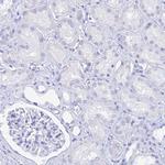 MCM2 Antibody in Immunohistochemistry (Paraffin) (IHC (P))