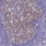 MCM2 Antibody in Immunohistochemistry (Paraffin) (IHC (P))