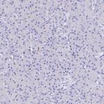 MCM2 Antibody in Immunohistochemistry (Paraffin) (IHC (P))