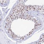 MCM2 Antibody in Immunohistochemistry (Paraffin) (IHC (P))