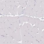 PMEL Antibody in Immunohistochemistry (Paraffin) (IHC (P))