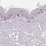 PMEL Antibody in Immunohistochemistry (Paraffin) (IHC (P))