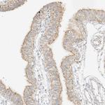 MIPEP Antibody in Immunohistochemistry (Paraffin) (IHC (P))