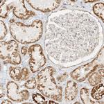 MIPEP Antibody in Immunohistochemistry (Paraffin) (IHC (P))