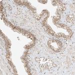 MIPEP Antibody in Immunohistochemistry (Paraffin) (IHC (P))