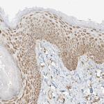 MIPEP Antibody in Immunohistochemistry (Paraffin) (IHC (P))