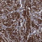 MYLK Antibody in Immunohistochemistry (Paraffin) (IHC (P))