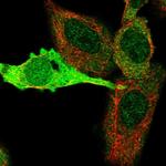 KYNU Antibody in Immunocytochemistry (ICC/IF)