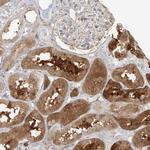 KYNU Antibody in Immunohistochemistry (Paraffin) (IHC (P))