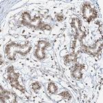 ZMYM2 Antibody in Immunohistochemistry (Paraffin) (IHC (P))