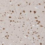 ZMYM2 Antibody in Immunohistochemistry (Paraffin) (IHC (P))