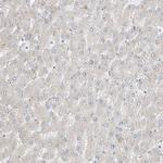 ZMYM2 Antibody in Immunohistochemistry (Paraffin) (IHC (P))