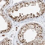 ZMYM2 Antibody in Immunohistochemistry (Paraffin) (IHC (P))