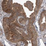 LATS1 Antibody in Immunohistochemistry (Paraffin) (IHC (P))