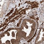 LATS1 Antibody in Immunohistochemistry (Paraffin) (IHC (P))