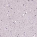 CXCR2 Antibody in Immunohistochemistry (Paraffin) (IHC (P))