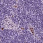 CXCR2 Antibody in Immunohistochemistry (Paraffin) (IHC (P))