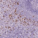 CXCR2 Antibody in Immunohistochemistry (Paraffin) (IHC (P))