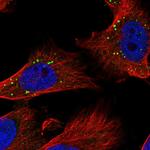 ZC3H12A Antibody in Immunocytochemistry (ICC/IF)