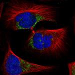 SLC11A2 Antibody in Immunocytochemistry (ICC/IF)