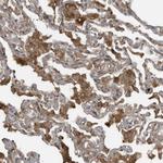 DDIT4 Antibody in Immunohistochemistry (Paraffin) (IHC (P))