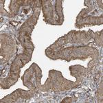 DDIT4 Antibody in Immunohistochemistry (Paraffin) (IHC (P))