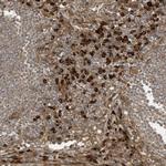 DDIT4 Antibody in Immunohistochemistry (Paraffin) (IHC (P))