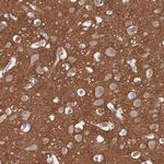 beta Adducin Antibody in Immunohistochemistry (Paraffin) (IHC (P))