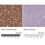 beta Adducin Antibody