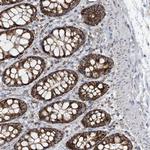 PNPase Antibody in Immunohistochemistry (Paraffin) (IHC (P))