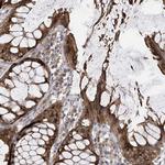 PNPase Antibody in Immunohistochemistry (Paraffin) (IHC (P))