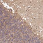 Dynactin 1 Antibody in Immunohistochemistry (Paraffin) (IHC (P))