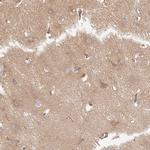 Dynactin 1 Antibody in Immunohistochemistry (Paraffin) (IHC (P))