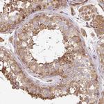 Dynactin 1 Antibody in Immunohistochemistry (Paraffin) (IHC (P))