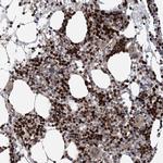 KIF4A Antibody in Immunohistochemistry (Paraffin) (IHC (P))