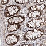 KIF4A Antibody in Immunohistochemistry (Paraffin) (IHC (P))