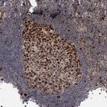 KIF4A Antibody in Immunohistochemistry (Paraffin) (IHC (P))