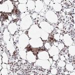 KIF4A Antibody in Immunohistochemistry (Paraffin) (IHC (P))