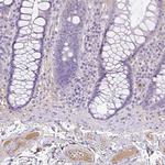 Tetranectin Antibody in Immunohistochemistry (Paraffin) (IHC (P))