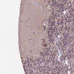 UBA3 Antibody in Immunohistochemistry (Paraffin) (IHC (P))