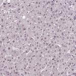 UBA3 Antibody in Immunohistochemistry (Paraffin) (IHC (P))