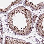 UBA3 Antibody in Immunohistochemistry (Paraffin) (IHC (P))