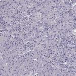 BACH1 Antibody in Immunohistochemistry (Paraffin) (IHC (P))