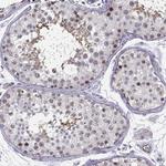 BACH1 Antibody in Immunohistochemistry (Paraffin) (IHC (P))