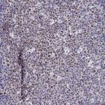 BACH1 Antibody in Immunohistochemistry (Paraffin) (IHC (P))