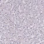 DNA-PK Antibody in Immunohistochemistry (Paraffin) (IHC (P))