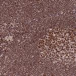 DNA-PK Antibody in Immunohistochemistry (Paraffin) (IHC (P))