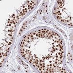 DNA-PK Antibody in Immunohistochemistry (Paraffin) (IHC (P))