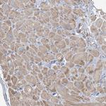 PEAR1 Antibody in Immunohistochemistry (Paraffin) (IHC (P))