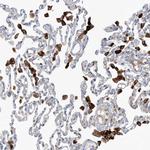 PEAR1 Antibody in Immunohistochemistry (Paraffin) (IHC (P))